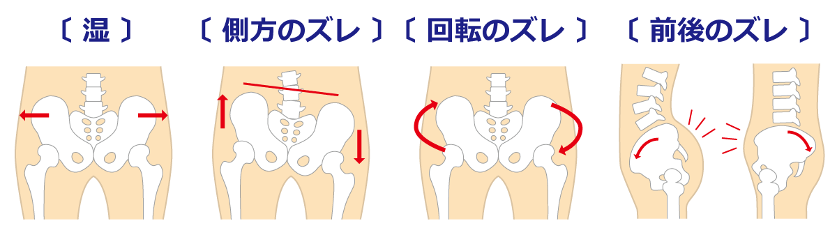 産後の骨盤矯正 診断