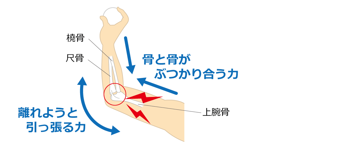 福岡市 野球肘治療